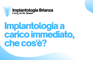 Implantologia a carico immediato, che cos'è?