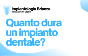 Durata Impianto Dentale Implantologia Monza e Brianza