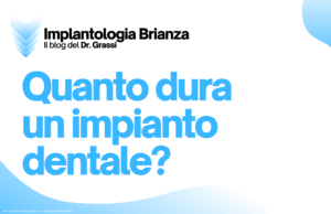 Quanto dura un impianto dentale?