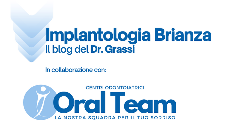 Implantologia Brianza